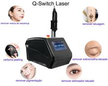 Laser Q-Switch – Remoção de Tatuagem, Microblading & Hollywood Laser Peel