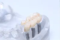 elitedentallab