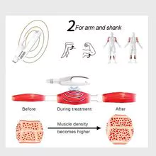 EMS塑形机用于瘦身构建肌肉
