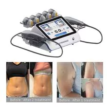 Anti Aging 7D Hifu Beauty Machine for Fat Reduction