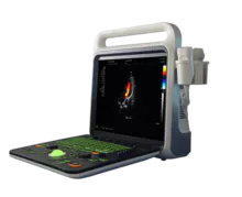 B-ultrasound, color ultrasound