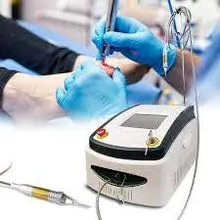 Factory price laser system for onychomycosis nail fungus treatment medical equipment podiatry nail 