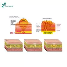 机器Fu4.5-5s海富面部提升机/专业医疗设备海福