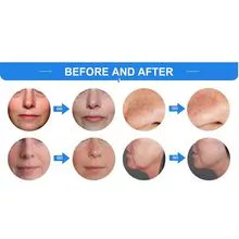 Equipo facial profesional de cuidado de la piel con oxígeno G882A