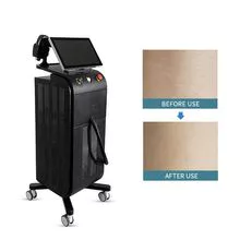 OEM ODM 2000W Diode Laser Permanent Hair Removal Machine for Distributor