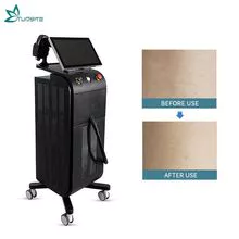 High-Power Hair Removal Machine Diode Laser 808nm