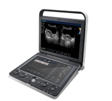 Portable Color Doppler Ultrasound System